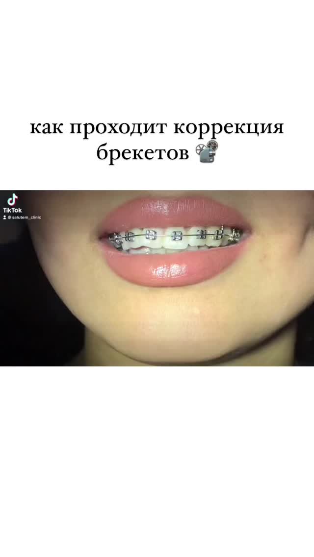 Результат лечения