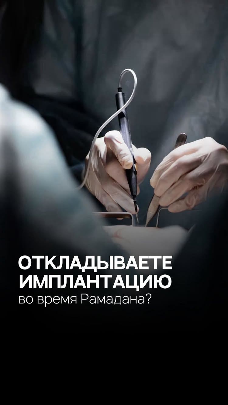 Имплантация зубов